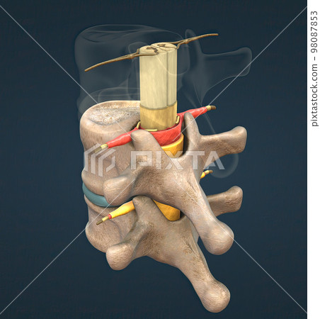 The spinal nerve is a mixed nerve that carries motor, sensory and autonomic signals between the spinal cord and the body 98087853