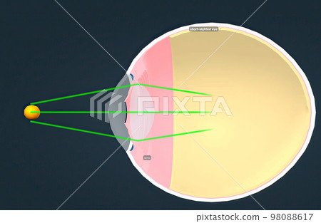 Structure of the Human Eye and anatomy of vision Structure of the Human Eye and anatomy of vision 98088617