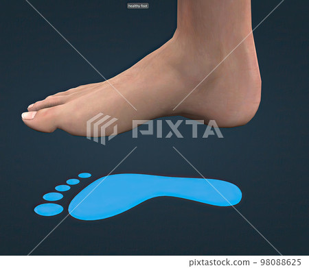 Healthy foot and blue footprint Healthy foot and blue footprint 98088625
