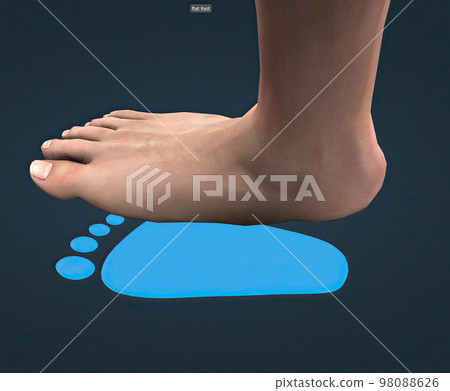 Feet flattening hot sale