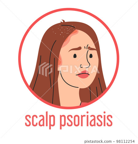 Scalp psoriasis. Sad woman with red itchy spots 98112254