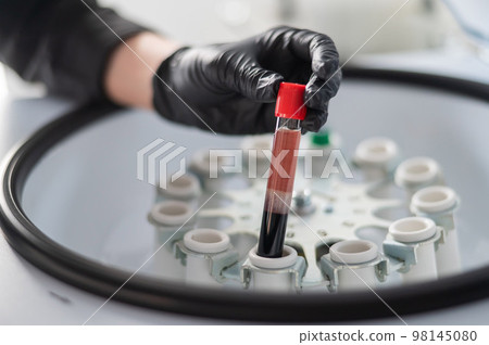 The doctor takes out a test tube with blood plasma from the centrifuge. Plasma lifting procedure for skin rejuvenation. The doctor takes out a test tube with blood plasma from the centrifuge. Plasma lifting procedure for skin rejuvenation. 98145080