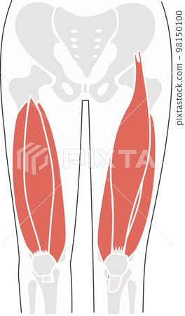 A simple illustration of the skeleton of the pelvis and thighs and the quadriceps muscle 98150100
