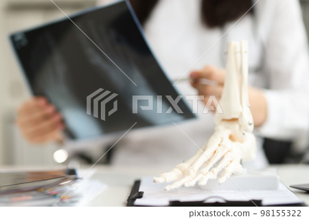 Doctor holds x-ray of foot and anatomy of bones of leg Doctor holds x-ray of foot and anatomy of bones of leg 98155322