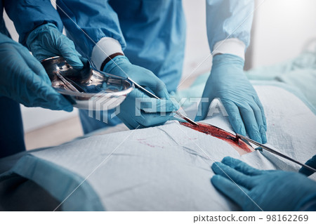 Doctors, nurses or surgery hands on cut patient in hospital emergency room for stomach ulcer, heart attack or burst appendix. Zoom, healthcare workers or surgical operation and steel metal equipment 98162269