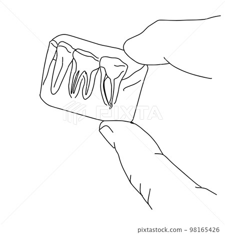 hand holding teeth x-ray 98165426