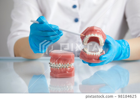 Orthodontist showing model of human jaw with wire braces and aligners explaining the difference 98184625