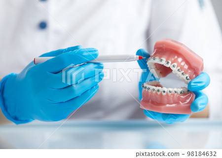 Doctor orthodontist showing model of human jaw with wire braces attached Doctor orthodontist showing model of human jaw with wire braces attached 98184632
