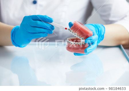 Doctor orthodontist showing model of human jaw with wire braces attached 98184633