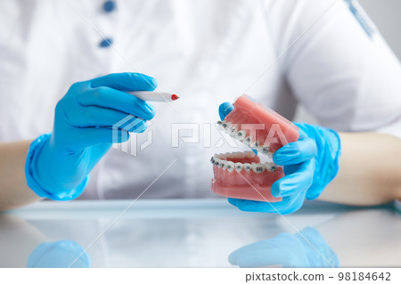 Doctor orthodontist showing model of human jaw with wire braces attached 98184642