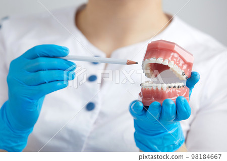 Orthodontist showing model of human jaw with wire braces and aligners explaining the difference 98184667