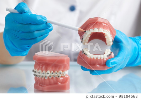 Orthodontist showing model of human jaw with wire braces and aligners explaining the difference 98184668