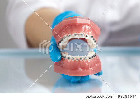 Doctor orthodontist showing model of human jaw with wire braces attached 98184684