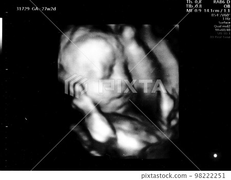 Ultrasound photo of a fetus at 27 weeks of gestation Ultrasound photo of a fetus at 27 weeks of gestation 98222251