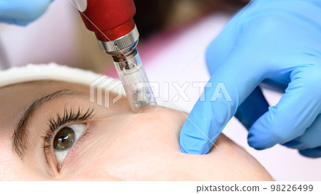 The process of rejuvenation and moisturizing with the help of the darsonval cosmetology device. The process of rejuvenation and moisturizing with the help of the darsonval cosmetology device. 98226499