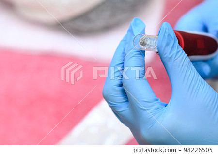Preparation of dermapen for the rejuvenation procedure. Preparation of dermapen for the rejuvenation procedure. 98226505