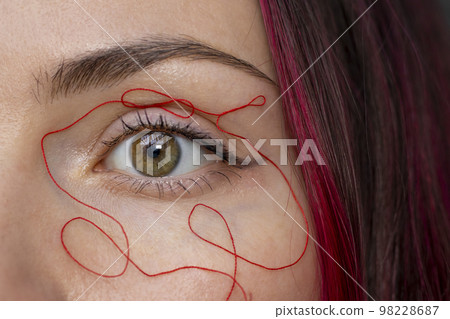 The concept of red and blue spider veins and dilated eyelids around the eyes. Female eye close up. The concept of red and blue spider veins and dilated eyelids around the eyes. Female eye close up. 98228687