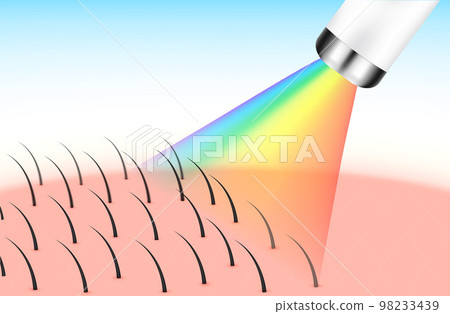 IPL laser light hair removal unwanted out make skin smooth. Medical beauty concept. 3D Realistic vector EPS10. Silver labels are used for product label design. IPL laser light hair removal unwanted out make skin smooth. Medical beauty concept. 3D Realistic vector EPS10. Silver labels are used for product label design. 98233439