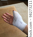 手腕在肌腱切開手術後，拇指包紮的手 98273211