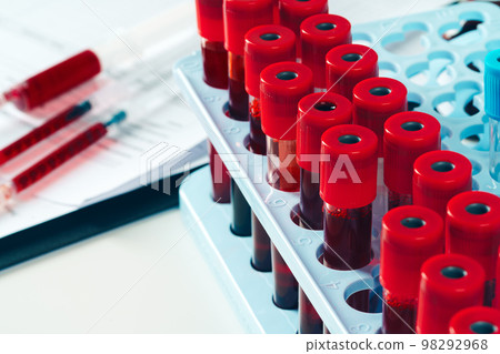 Close-up of test tubes arranged on a table in medical laboratory 98292968