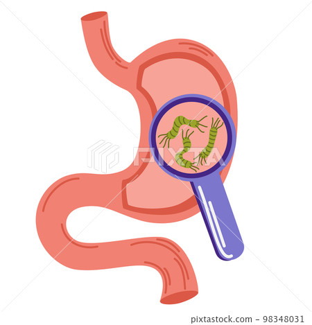 Helicobacter Pylori in the stomach. Bacteria under magnifying glass. Stomach diseases. Unhealthy stomach concept. Heartburn, illness, discomfort, pain. Flat vector illustration isolated on white Helicobacter Pylori in the stomach. Bacteria under magnifying glass. Stomach diseases. Unhealthy stomach concept. Heartburn, illness, discomfort, pain. Flat vector illustration isolated on white 98348031