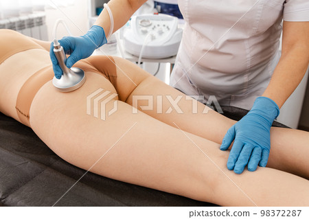 Applying vacuum roller massage for womans abdomen using a nozzle 98372287