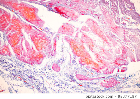 Tissue of Small intestine (Duodenum), Large intestine Human and Stomach Human under the microscope in Lab. 98377187