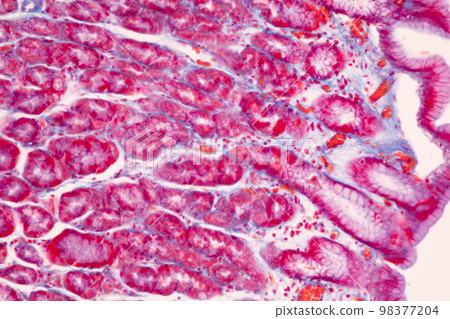 Tissue of Small intestine (Duodenum), Large intestine Human and Stomach Human under the microscope in Lab. Tissue of Small intestine (Duodenum), Large intestine Human and Stomach Human under the microscope in Lab. 98377204