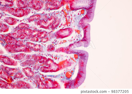 Tissue of Small intestine (Duodenum), Large intestine Human and Stomach Human under the microscope in Lab. 98377205