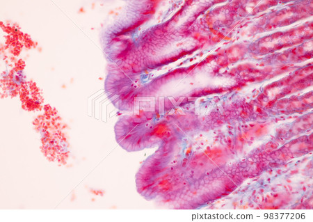 Tissue of Small intestine (Duodenum), Large intestine Human and Stomach Human under the microscope in Lab. 98377206