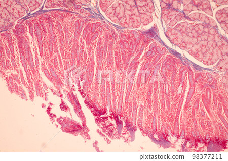 Tissue of Small intestine (Duodenum), Large intestine Human and Stomach Human under the microscope in Lab. 98377211