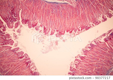 Tissue of Small intestine (Duodenum), Large intestine Human and Stomach Human under the microscope in Lab. Tissue of Small intestine (Duodenum), Large intestine Human and Stomach Human under the microscope in Lab. 98377217