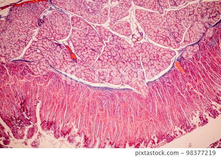 Tissue of Small intestine (Duodenum), Large intestine Human and Stomach Human under the microscope in Lab. 98377219