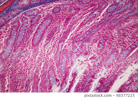 Tissue of Small intestine (Duodenum), Large intestine Human and Stomach Human under the microscope in Lab. Tissue of Small intestine (Duodenum), Large intestine Human and Stomach Human under the microscope in Lab. 98377225