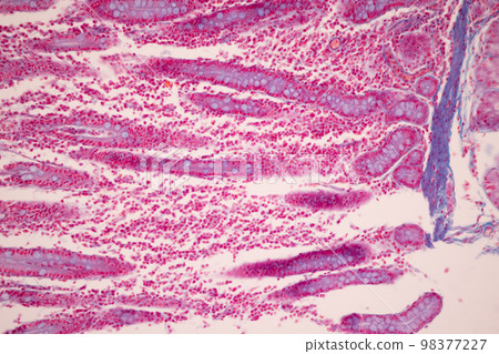 Tissue of Small intestine (Duodenum), Large intestine Human and Stomach Human under the microscope in Lab. Tissue of Small intestine (Duodenum), Large intestine Human and Stomach Human under the microscope in Lab. 98377227