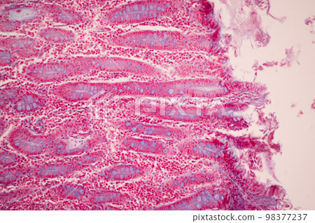 Tissue of Small intestine (Duodenum), Large intestine Human and Stomach Human under the microscope in Lab. 98377237