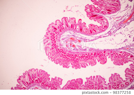 Tissue of Small intestine (Duodenum), Large intestine Human and Stomach Human under the microscope in Lab. Tissue of Small intestine (Duodenum), Large intestine Human and Stomach Human under the microscope in Lab. 98377258