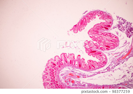 Tissue of Small intestine (Duodenum), Large intestine Human and Stomach Human under the microscope in Lab. 98377259
