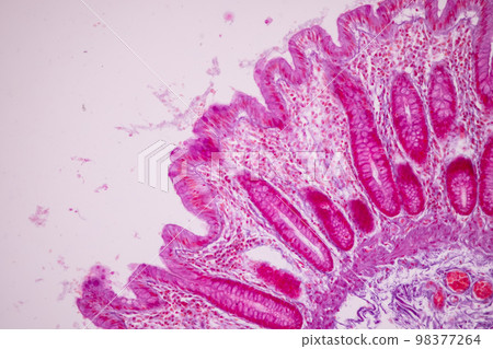 Tissue of Small intestine (Duodenum), Large intestine Human and Stomach Human under the microscope in Lab. 98377264
