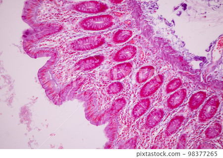 Tissue of Small intestine (Duodenum), Large intestine Human and Stomach Human under the microscope in Lab. Tissue of Small intestine (Duodenum), Large intestine Human and Stomach Human under the microscope in Lab. 98377265