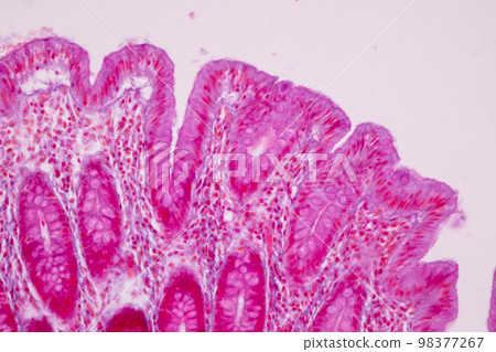 Tissue of Small intestine (Duodenum), Large intestine Human and Stomach Human under the microscope in Lab. 98377267