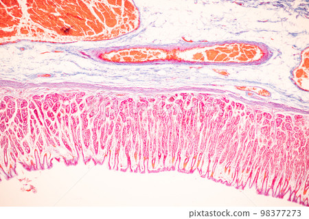 Tissue of Small intestine (Duodenum), Large intestine Human and Stomach Human under the microscope in Lab. 98377273