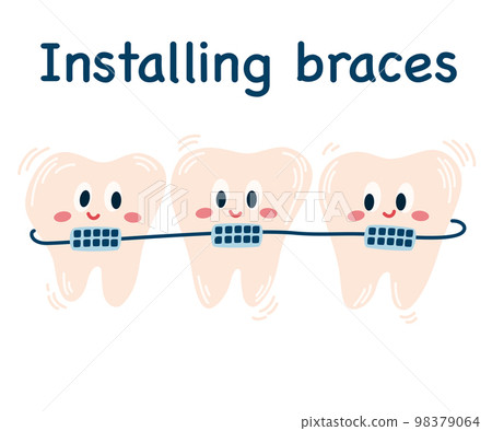 0063_braces 98379064