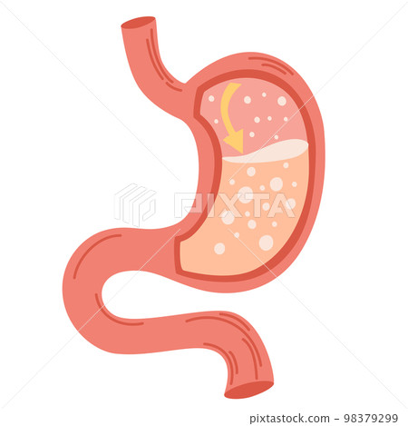 Human stomach. Gastroesophageal reflux disease concept. Unhealthy stomach concept. Heartburn, illness, discomfort, pain. Flat vector illustration isolated on white 98379299