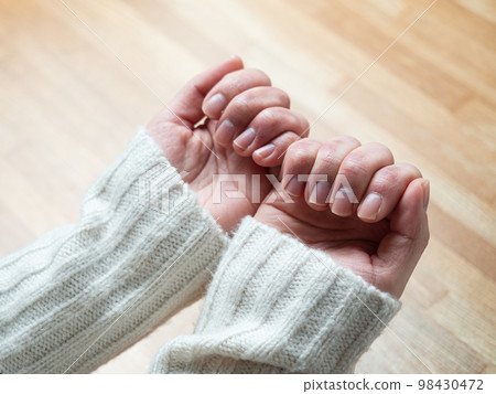 女人的手凍傷腫脹乾裂 98430472