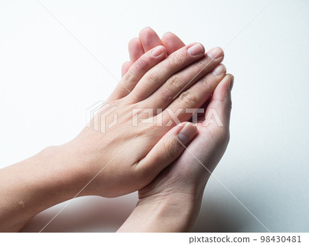 A woman's hand swollen with frostbite and chapped hands 98430481