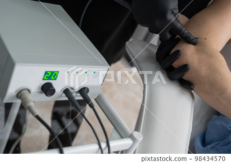 Dermatologist removes a mole on a patient's arm using an electrocoagulator. Dermatologist removes a mole on a patient's arm using an electrocoagulator. 98434570