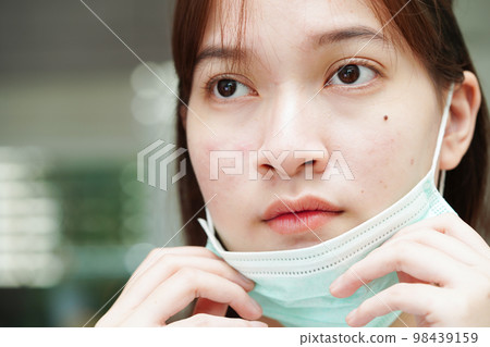 Acne pimple and scar on skin face, disorders of sebaceous glands, teenage girl skincare beauty problem. Acne pimple and scar on skin face, disorders of sebaceous glands, teenage girl skincare beauty problem. 98439159