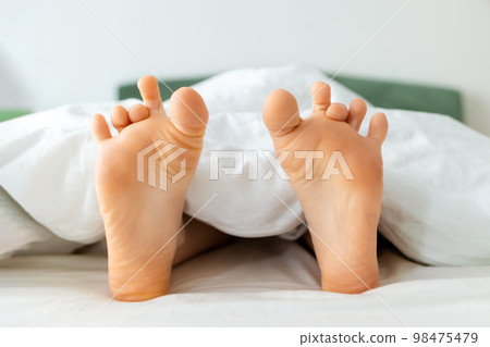 Funny female bare feet with crooked fingers in close-up. White bedding. Dry soles. Concept of pedicure and rest 98475479