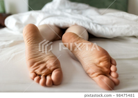 Person's legs sticking out under blanket. Barefeet close-up with dry calluses and corns 98475481